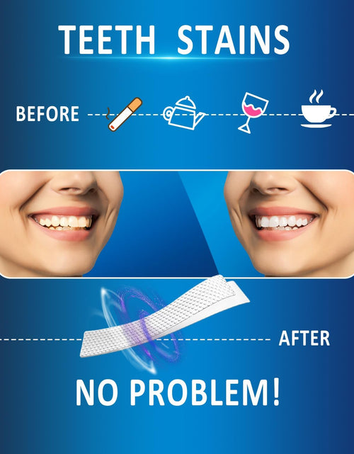 Load image into Gallery viewer, Teeth Whitening Strips 14 Treatments, 28 White Strips for Teeth Whitening, Non-Sensitive Whitening Strips for Tooth Whitening, Helps to Remove Smoking Coffee Soda Wine Stain, 10 Shades Whiter
